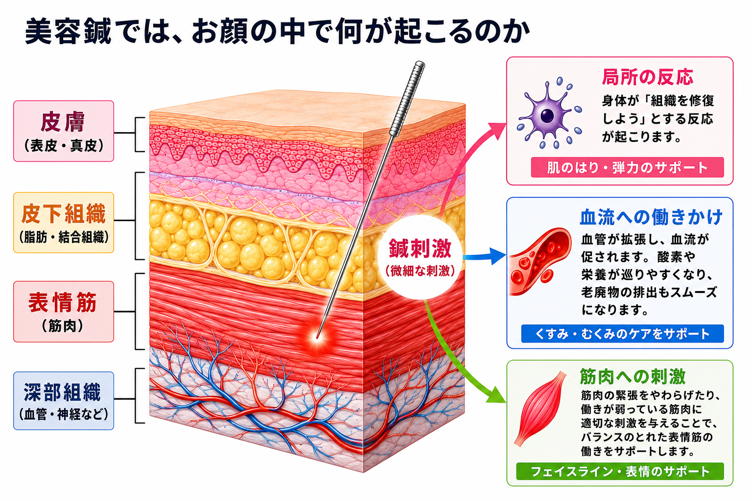 鍼が皮膚・皮下組織・筋肉にアプローチするイメージ